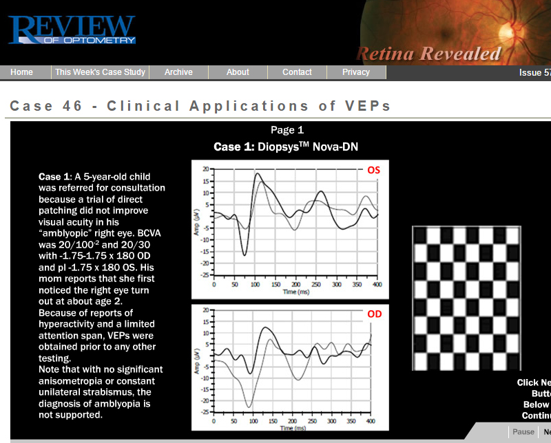 Clinical Applications of VEP