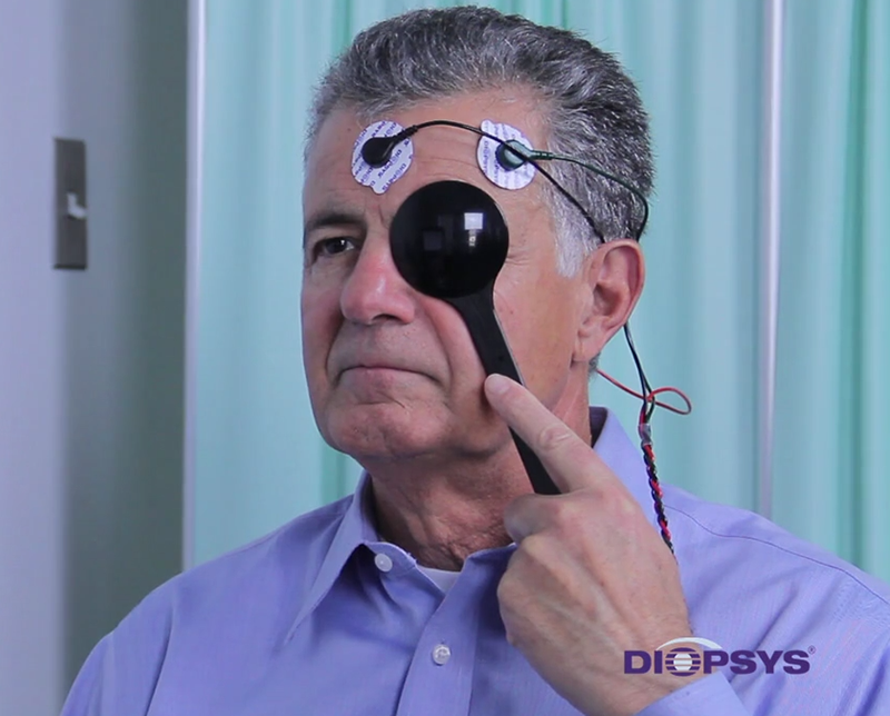 Diopsys VEP Patient Preparation