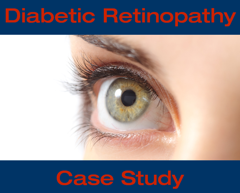 Diabetic Retinopathy ffERG Case Study